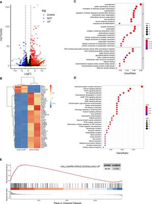 SUZ12 Loss Amplifies the Ras/ERK Pathway by Activating Adenylate Cyclase 1 in NF1-Associated Neurofibromas